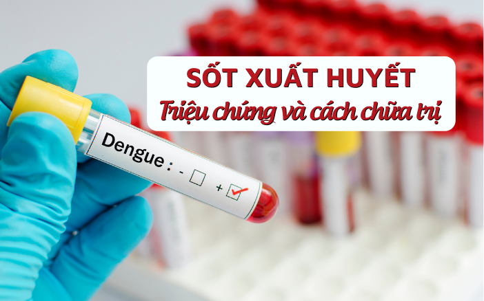 Sốt xuất huyết - Triệu chứng và cách chữa trị