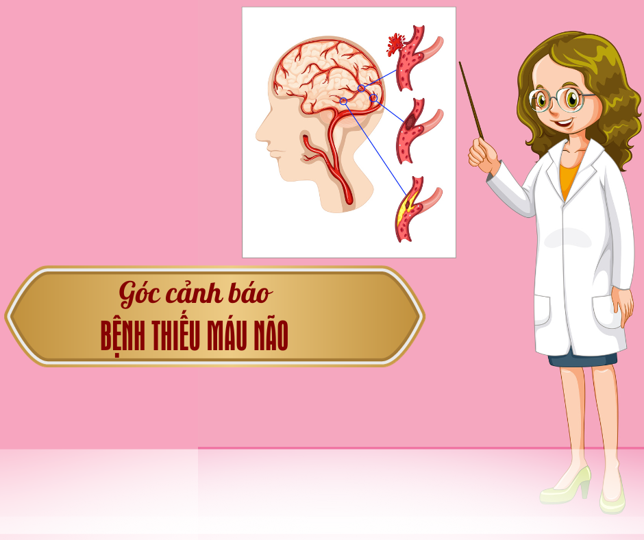 Góc giải đáp: Bệnh thiếu máu não nguyên nhân triệu chứng và biện pháp khắc phục